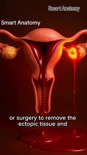 Ectopic Pregnancy: Signs and Dangers Explained