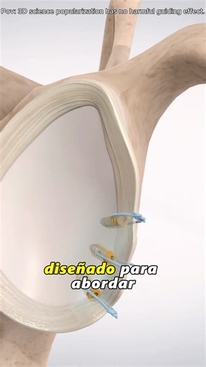 How Arthroscopic Bankart Repair Surgery Is Performed (3D Animation)#bankartrepair#labrumtear