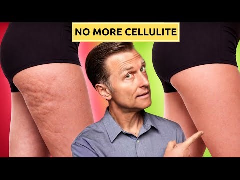 The #1 Best Way to Lose Hip & Butt Cellulite