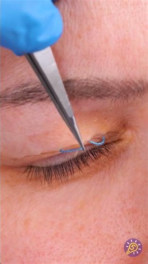 Este procedimiento de belleza es bastante inusual 😳💄