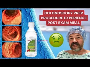 COLONOSCOPY EXPERIENCE | Prep, Procedure, & Post-Exam Meal | Magnesium Citrate Reaction | Colon Exam