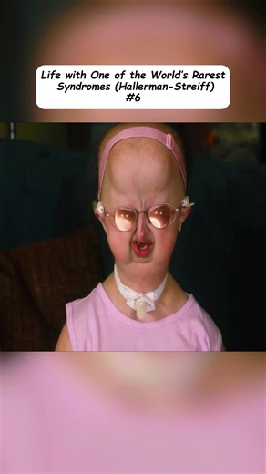 #SBSK #Disability #Autism #Inclusion #Schizophrenia | schizophrenic