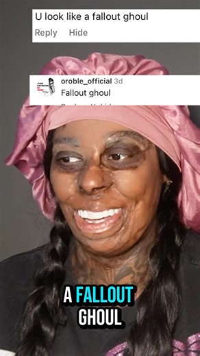 Reading my hate comments, I'm a fallout ghoul??? #burnsurvivor