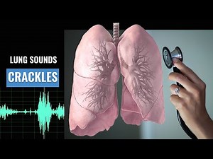 Fine Crackles lung sound | Fine Crackles | Christina NP | Caring Casa