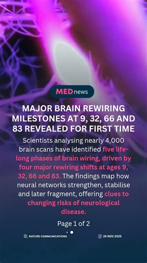 🧠 Major brain rewiring milestones revealed at 9, 32, 66 and 83 #brain #aging #neurology #health