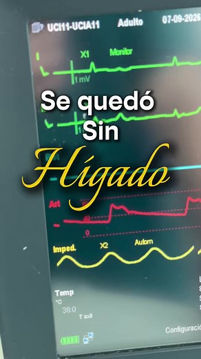 ¿Se puede vivir sin hígado? Riesgos y relación con el hígado graso