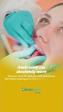 What Every Adult Should Know Before Getting Invisalign