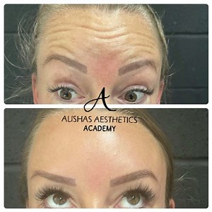 Just magic 🪄 rewind the clock 🕰 Book you free consultation ✔️ @the_bronzing_shop | Alisha's Aesthetics