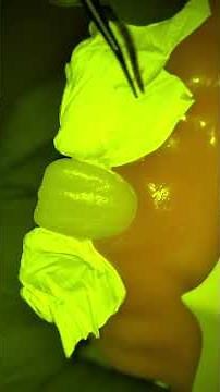 Composite Injection Technique