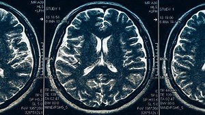 12K views · 12 reactions | According to experts, concussions affect tens of thousands of kids in the U.S. each year. Watch Chris Nowinski of the Concussion Legacy Foundation share the telltale signs of a concussion and an initiative that aims to increase awareness and reporting: https://comca.st/3mmo26k | Comcast Newsmakers | Facebook