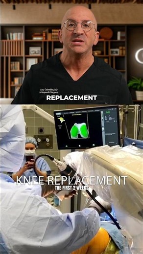 What Your First Two Weeks After Knee Replacement Should Actually Look Like