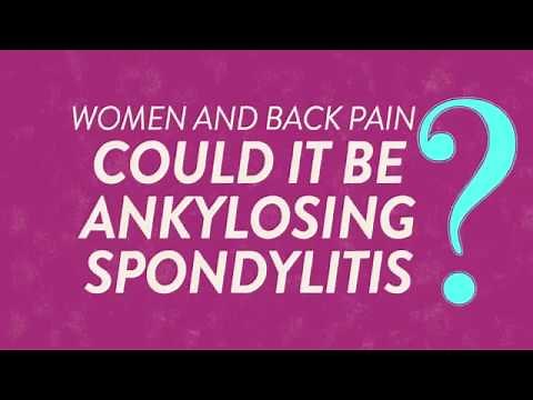 What Causes Back Pain In Women? Learn About AS | Backsplaining