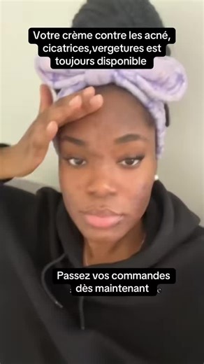 Votre crème réparatrice de cicatrices,acné, vergetures est toujours disponible #skincare #cicatrices #glowup #cotedivoire🇨🇮