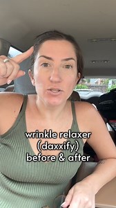 Thank you to Retro Spa & Wellness again for keeping me confident & my wrinkles relaxed 😘 this is the before & after with Daxxify #wrinklefree #WrinkleTreatment #fayettevillenc #botox #botoxresults #beforeandafter #lipflip #lipflipbotox #daxxify #daxxifybeforeandafter | Kilee Rainbow