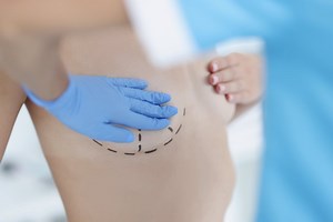 Tout savoir sur l'opération des seins