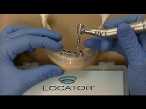 Zest LODI Mandibular Guided Surgery Demonstration / Technique
