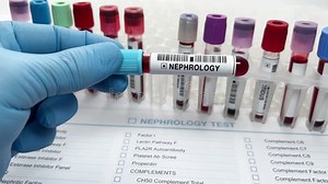 Doctor Working with Blood Drawn for Nephrology Test Stock Footage - Video of kidney, chemistry: 262276768