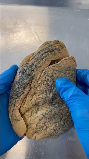 Real Human Lung!