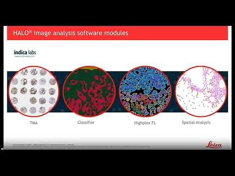 Cell DIVE a robust platform for multiplexed whole slide imaging and single cell analysis
