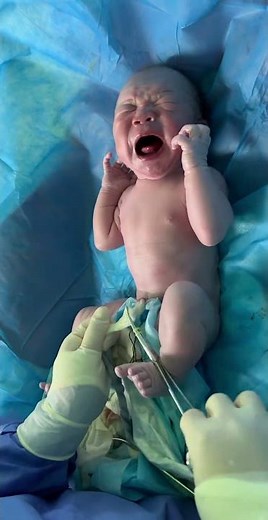 This Is What a Newborn Looks Like in the First Minutes of Life #newbornbaby