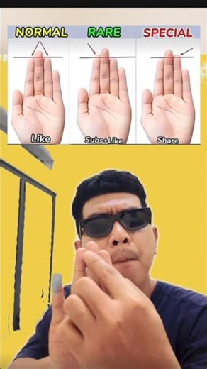 [189] Normal Rare or Special?