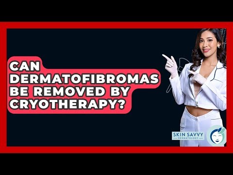 Can Dermatofibromas Be Removed By Cryotherapy? - Skin Savvy Dermatology