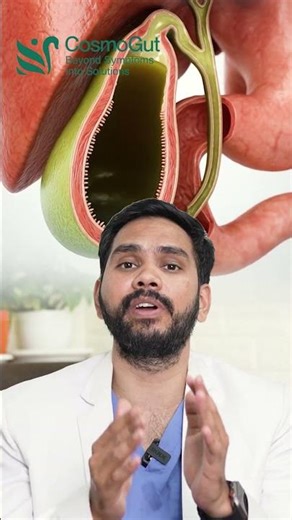 Who Produces Bile Liver or Gallbladder | Doctor Explains #drraghuteja #healthawareness #guthealth