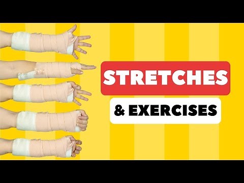 Tight Fingers & Hand after Cast (Broken Wrist) Stretches & Exercises