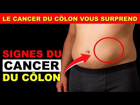SYMPTÔMES DU CANCER DU CÔLON - 10 signes avant-coureurs du cancer du côlon