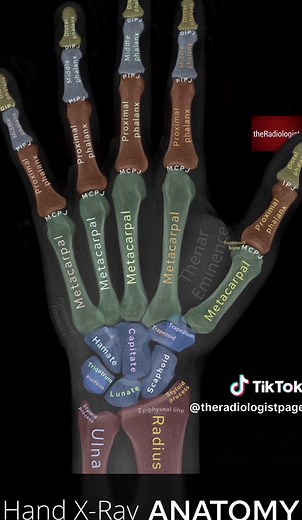 Hand X-Ray Anatomy #anatomy #xray #radiology #radiologist #radtech #doctor #radiography #emergencymedicine #nursepractitioner #physicianassistant