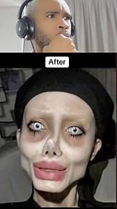 14K views · 642 reactions | Celebrity Plastic Surgery Disasters  | Mansa Mayne | Facebook
