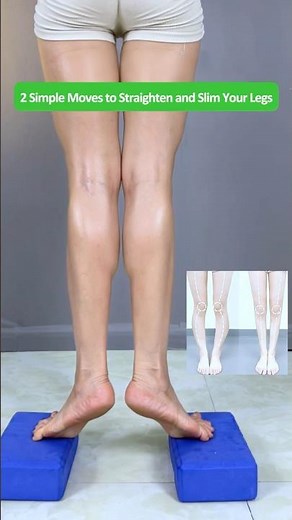 2 Daily Steps to Fix O Shaped Legs and Sculpt Long, Straight, and Beautiful Legs