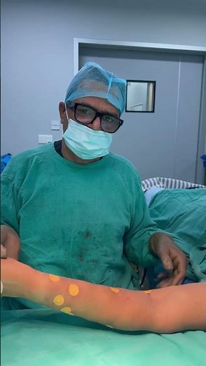Lipoma Treatment: What Is the Best Treatment for a Lipoma? | #Short