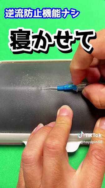 逆流防止弁の重要性と留置針のルート確保方法について