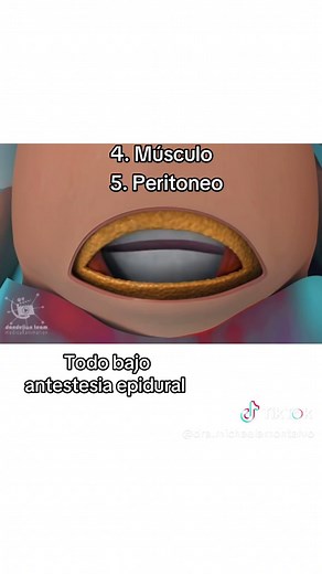 Entiende la cesárea: Proceso y detalles clave