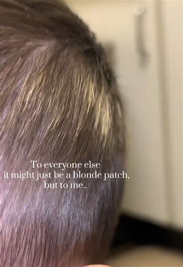 He has had it since he was born, but I swear their souls are tethered together- their brotherhood is so beautiful to watch. 🥺🫶🏼🥹🤌🏼✨ #brotherhood #myboys #soulsconnected #Godsgifts