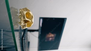 vertical video skull model on the background of a computer screen with a 3D image in a tomography or surgery room in a clinic