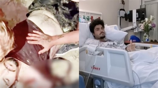 Video: Florida Man Gets Attacked Outside of a Bar by an Alligator; Reptile Bites Off His Arm