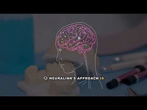 Everything You Need to Know About Neuralink: Brain-Computer Interfaces Explained
