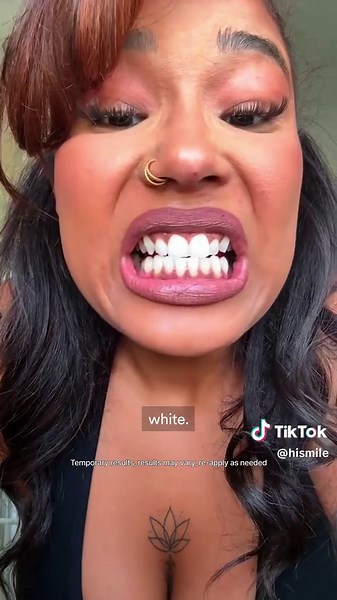 Effective Teeth Whitening Strips That Work Fast