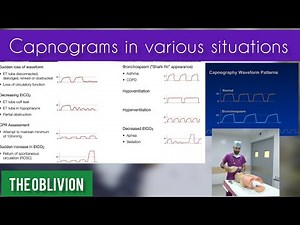 End tidal Carbon Dioxide(CO2) Monitoring. Capnograms in various situations#medical#EtCO2#anaesthetic