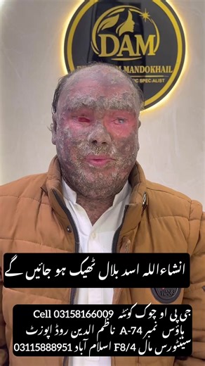 Doctor Abraham (@doctor_ibrahim_skin)’s videos with original sound - Doctor Abraham