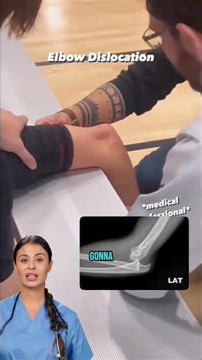 Fixing a dislocated elbow 😳