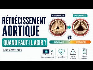 Aortic Stenosis: At What Stage Does Surgery Become an Absolute Emergency?