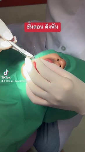 รีวิวขั้นตอนการจัดฟันที่คลินิกพัทลุง