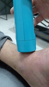 If you want to have a device with 6 inbuilt physio modalities that is portable - this is the best device that is capable of it. Use my link and coupon code to get 15% off https://synergotron.myshopify.com?ta_aff=NNAHLEDY9K&discount=THRUSTIERE25 #healeex #sportstherapy #physiotherapy #electrotherapy #massagetherapy | Adnan Kojić