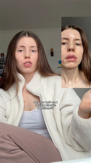 allergic to living life