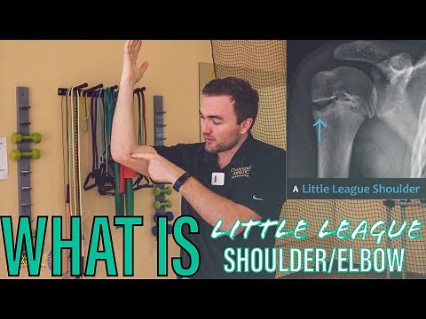 What is Little League Elbow/Shoulder? | MAJOR Injury!