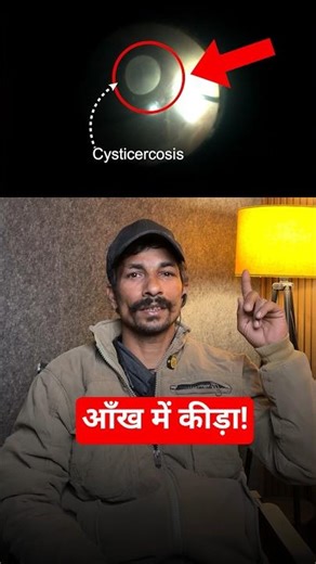 Aankh mai Kededa - Patient Story & Vision Saved