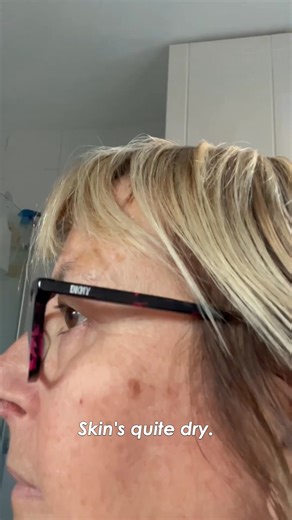 🟤 75% of women 40 get dark spots. 🧪 Most products use harsh ingredients and don’t treat the real cause. 🍇 The 5 Step Clear Skin Kit is formulated with polyphenols to help fade the appearance of hyperpigmentation. 🌿 98% natural and suitable for sensitive skin. ✅ Try it risk-free with a 60-day money-back guarantee. 💚 Experience the transformation, your skin deserves it! | WildMint Cosmetics